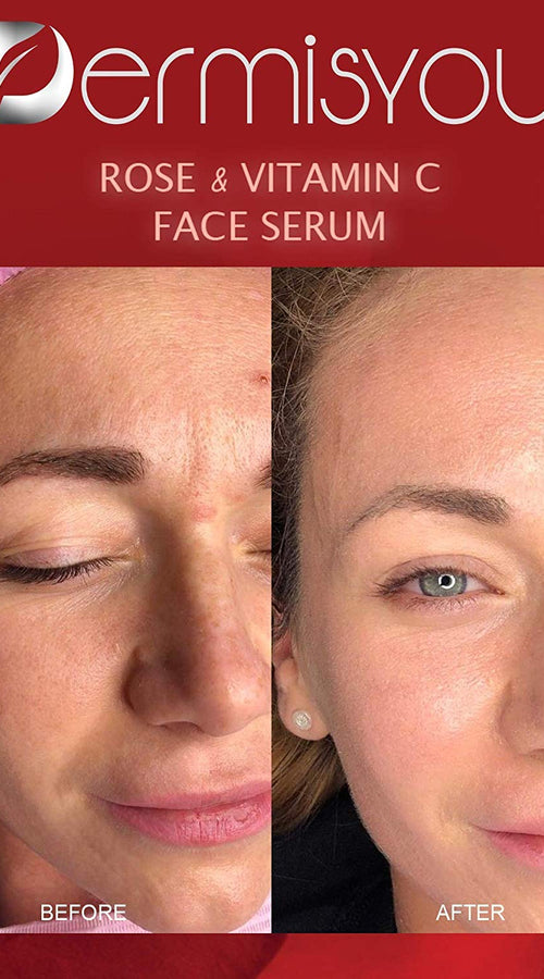 Load image into Gallery viewer, Anti-Wrinkle Facial Serum with Rose Water &amp; Vitamin C
